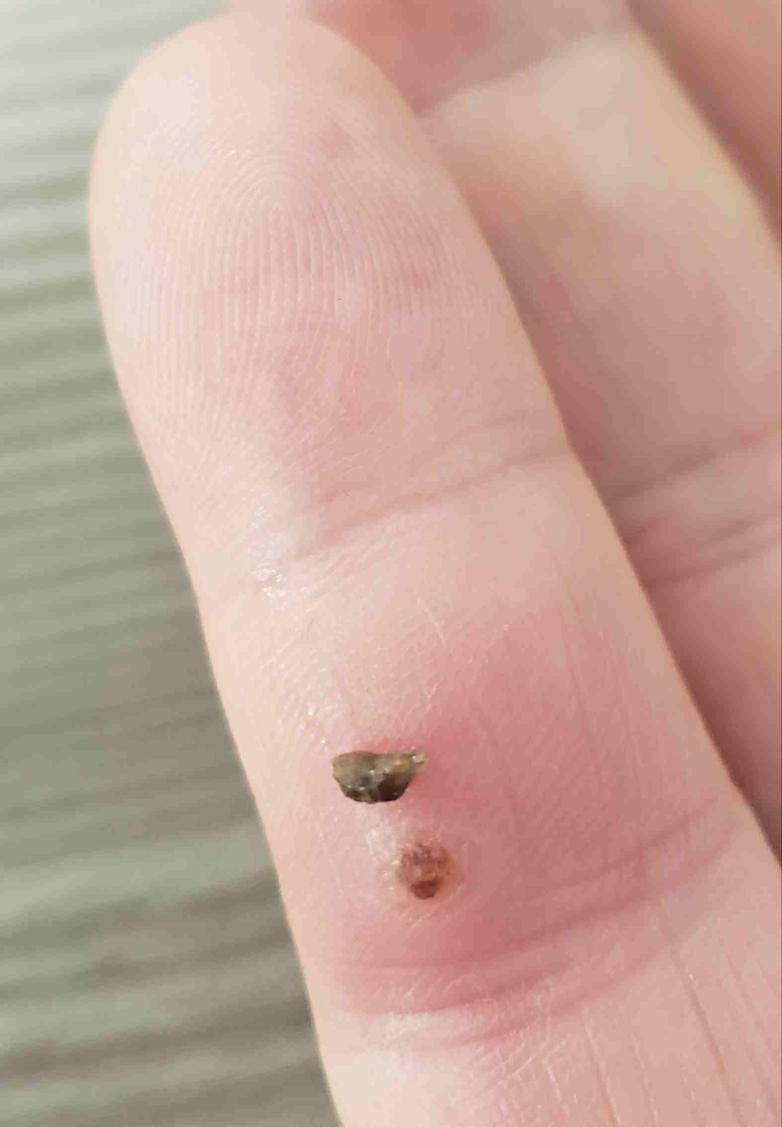2019-09-19 Wood be GONE.jpg